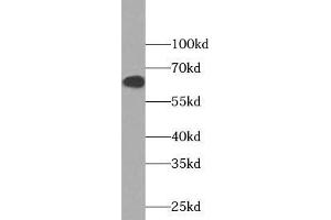 Western blot analysis of Jurkat cells subjected to SDS-PAGE, using NOX5 antibody (1:1000 dilution). (NOX5 Antikörper)