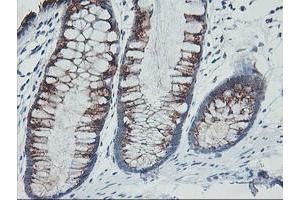 Immunohistochemical staining of paraffin-embedded Human colon tissue using anti-GOLM1 mouse monoclonal antibody. (GOLM1 Antikörper)