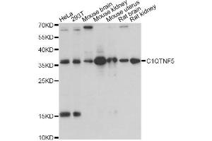 Western blot analysis of extracts of various cell lines, using C1QTNF5 antibody (ABIN1871381) at 1:1000 dilution. (CTRP5 Antikörper)
