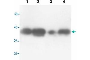 Western blot analysis of tissue lysates with TNFAIP1 polyclonal antibody . (TNFAIP1 Antikörper  (N-Term))