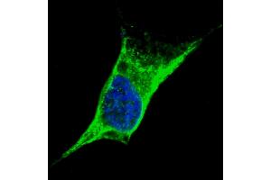 Fluorescent confocal image of SY5Y cells stained with Vimentin antibody. (Vimentin Antikörper  (C-Term))