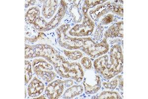 Immunohistochemistry (IHC) image for anti-Thrombospondin 1 (THBS1) (AA 80-360) antibody (ABIN3022979)