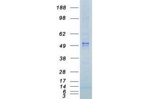 GSK3 alpha Protein (Myc-DYKDDDDK Tag)