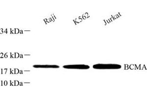 Western blot analysis of BCMA (ABIN7076067) at dilution of 1: 250 (BCMA Antikörper)