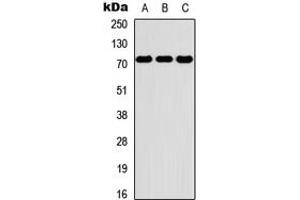 Western blot analysis of PKR expression in THP1 (A), NS-1 (B), PC12 (C) whole cell lysates. (EIF2AK2 Antikörper  (C-Term))