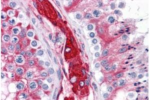 Human Testis: Formalin-Fixed, Paraffin-Embedded (FFPE) (WDR35 Antikörper  (N-Term))