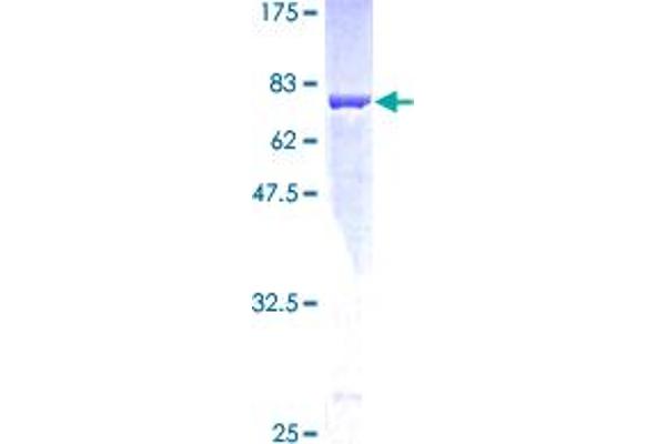 MAT1A Protein (AA 1-395) (GST tag)