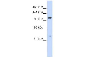 WB Suggested Anti-TRPC4 Antibody Titration:  0.