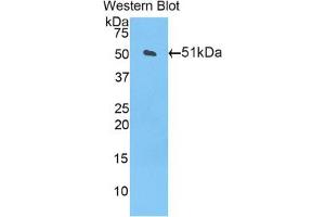 Western blot analysis of the recombinant protein. (CPT1A Antikörper  (AA 568-773))