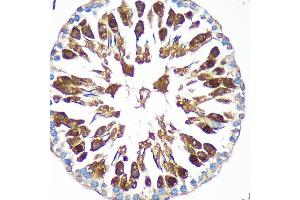 Immunohistochemistry of paraffin-embedded Rat testis using C Rabbit pAb (ABIN7266547) at dilution of 1:100 (40x lens). (CAND2 Antikörper  (AA 850-1000))