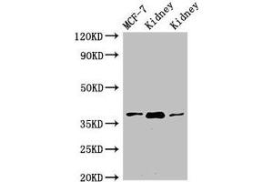 Western Blot Positive WB detected in: MCF-7 whole cell lysate, Rat kidney tissue, Mouse kidney tissue All lanes: HAO2 antibody at 3 μg/mL Secondary Goat polyclonal to rabbit IgG at 1/50000 dilution Predicted band size: 39, 41 kDa Observed band size: 39 kDa (Hydroxyacid Oxidase 2 (HAO2) (AA 2-200) Antikörper)