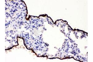 IHC testing of FFPE mouse lung with Mesothelin antibody.
