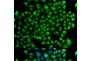 Immunofluorescence analysis of A549 cells using ZFYVE1 Polyclonal Antibody (ZFYVE1 Antikörper)