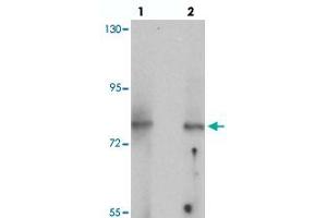 Western blot analysis of UHRF1BP1 in mouse kidney tissue with UHRF1BP1 polyclonal antibody  at (lane 1) 1 and (lane 2) 2 ug/mL. (UHRF1BP1 Antikörper  (Internal Region))