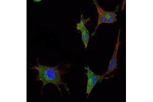 Immunofluorescence analysis of NTERA-2 cells using SMAD5 mouse mAb (green).