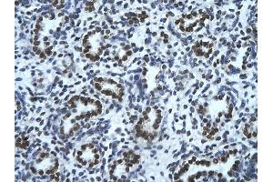 Rabbit Anti-HMGN1 Antibody       Paraffin Embedded Tissue:  Human alveolar cell   Cellular Data:  Epithelial cells of renal tubule  Antibody Concentration:   4. (HMGN1 Antikörper  (Middle Region))