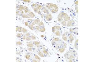 Immunohistochemistry of paraffin-embedded human stomach using MSMB antibody (ABIN6003799) at dilution of 1/100 (40x lens). (MSMB Antikörper)