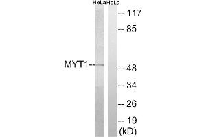 Western blot analysis of extracts from HeLa cells, using MYT1 (epitope around residue 83) antibody. (MYT1 Antikörper  (Ser83))