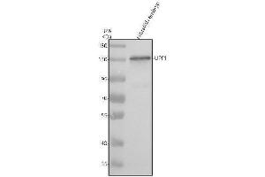 Western blot analysis of UPF1 using anti-UPF1 antibody (AZF1RCY6).