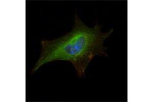 Immunofluorescence analysis of NIH/3T3 cells using FMR1 mouse mAb (green). (FMR1 Antikörper)