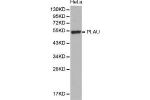 Western Blotting (WB) image for anti-Plasminogen Activator, Urokinase (PLAU) (AA 20-180) antibody (ABIN6219409) (PLAU Antikörper  (AA 20-180))