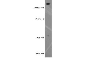 Western Blotting (WB) image for anti-Xin Actin-Binding Repeat Containing 2 (XIRP2) antibody (ABIN2906145) (XIRP2 Antikörper)