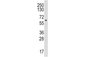 Western Blotting (WB) image for anti-Cytochrome P450, Family 19, Subfamily A, Polypeptide 1 (CYP19A1) (AA 221-253) antibody (ABIN3030682)