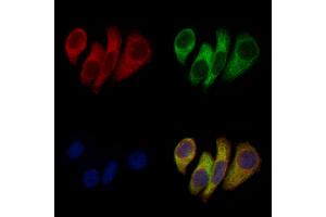 ABIN6257300 and ABIN6275375 staining Hela cells by IF/ICC.