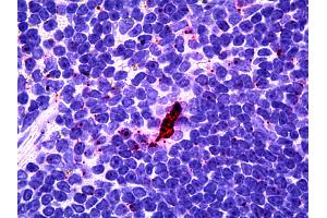 Anti-EBI3 antibody IHC of human lymphoid-dendritic cells. (EBI3 Antikörper)