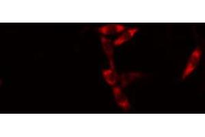ABIN6274586 staining HuvEc cells by IF/ICC. (AIM2 Antikörper  (Internal Region))