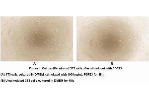 FGF23 Protein (AA 25-251) (His tag)