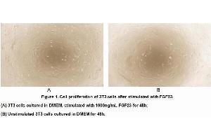 Image no. 2 for Fibroblast Growth Factor 23 (FGF23) (AA 25-251) (Active) protein (His tag) (ABIN6239859) (FGF23 Protein (AA 25-251) (His tag))