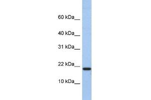 WB Suggested Anti-C1D Antibody Titration:  0. (C1D Antikörper  (N-Term))