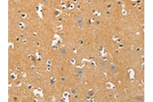 The image on the left is immunohistochemistry of paraffin-embedded Human brain tissue using ABIN7129239(DNM3 Antibody) at dilution 1/20, on the right is treated with fusion protein. (Dynamin 3 Antikörper)