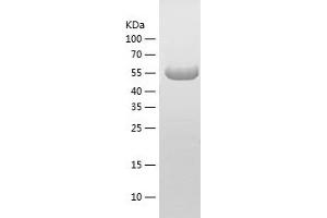 Western Blotting (WB) image for Stress-Induced-phosphoprotein 1 (STIP1) (AA 1-543) protein (His tag) (ABIN7125219)