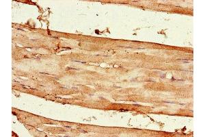 Immunohistochemistry of paraffin-embedded human skeletal muscle tissue using ABIN7167652 at dilution of 1:100 (Raptor Antikörper  (AA 13-128))