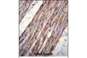 KCNJ8 Antibody (N-term) (ABIN656236 and ABIN2845552) immunohistochemistry analysis in formalin fixed and paraffin embedded human heart tissue followed by peroxidase conjugation of the secondary antibody and DAB staining.