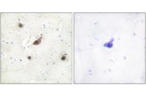 Immunohistochemistry analysis of paraffin-embedded human brain tissue, using B-RAF Antibody. (SNRPE Antikörper  (AA 171-220))