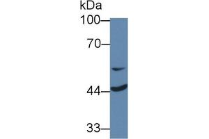 Western Blot; Sample: Human Jurkat cell lysate; Primary Ab: 1µg/ml Rabbit Anti-Rat MTUS1 Antibody Second Ab: 0.