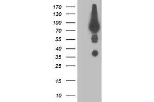 Western Blotting (WB) image for anti-Dipeptidyl-Peptidase 3 (DPP3) antibody (ABIN1497832)