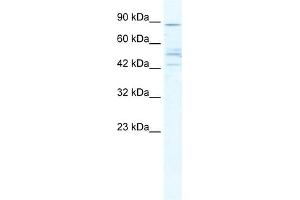 Western Blotting (WB) image for anti-Cholinergic Receptor, Nicotinic, beta 2 (Neuronal) (CHRNB2) (Middle Region) antibody (ABIN2780201)