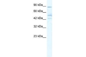 WB Suggested Anti-CHRNB2 Antibody Titration:  5. (CHRNB2 Antikörper  (Middle Region))