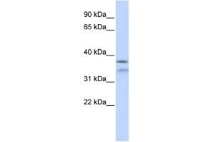WB Suggested Anti-HYLS1 Antibody Titration: 0. (HYLS1 Antikörper  (Middle Region))