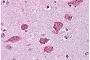 Immunohistochemistry (Formalin-fixed Paraffin-embedded Sections) (IHC (fp)) image for anti-Hepatocyte Growth Factor (Hepapoietin A, Scatter Factor) (HGF) (AA 216-265) antibody (ABIN604744)