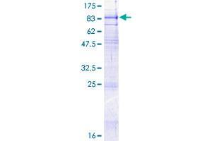 Solute Carrier Family 34 (Type II Sodium/phosphate Contransporter), Member 1 (SLC34A1) (AA 1-639) protein (GST tag)