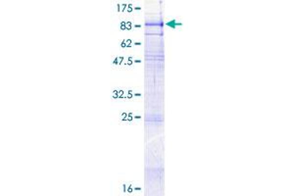 Solute Carrier Family 34 (Type II Sodium/phosphate Contransporter), Member 1 (SLC34A1) (AA 1-639) protein (GST tag)