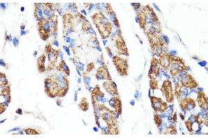 Immunohistochemistry of paraffin-embedded Human stomach using RNF149 Polyclonal Antibody at dilution of 1:100 (40x lens). (RNF149 Antikörper)
