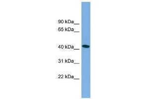 MAPT antibody used at 1 ug/ml to detect target protein. (MAPT Antikörper  (Middle Region))