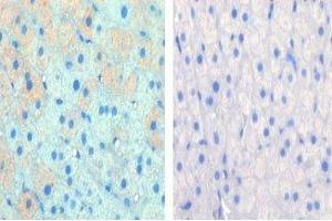 IHC data of FFPE cow lactation tissue tested with CPT1A antibody (left) and without primary Ab (right). (CPT1A Antikörper  (AA 606-636))
