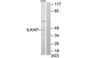 Western Blotting (WB) image for anti-Integrin-Linked Kinase-Associated Serine/threonine Phosphatase 2C (ILKAP) (AA 41-90) antibody (ABIN2889751) (ILKAP Antikörper  (AA 41-90))
